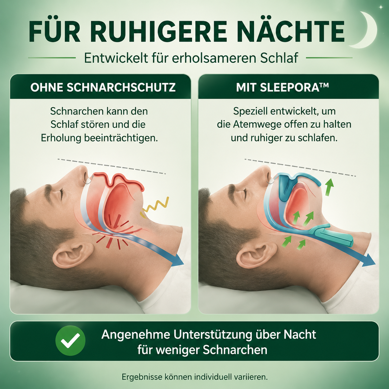 Sleepora™ Schnarchschutz-Mundstück